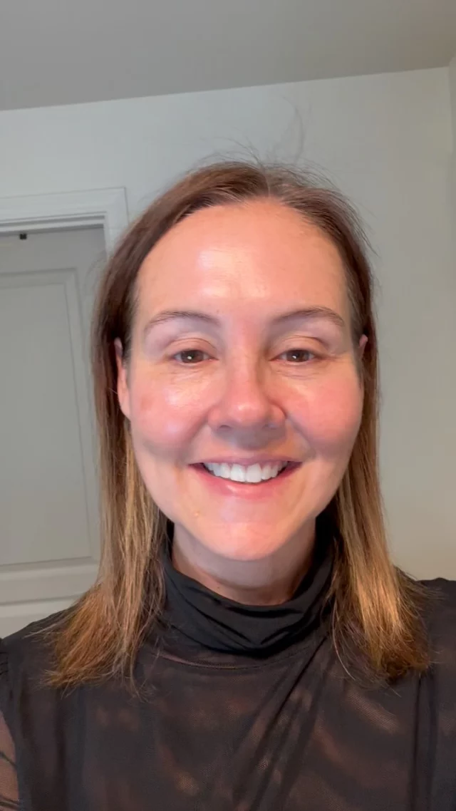 We are at day 8 of our BBL + HALO! 🌸 Our lovely patient has healed beautifully, and her skin is glowing!

Call us at (541)683-3238 to book your appointment or go online using the link in our bio / store.jewellaestheticmedspa.com! 💖 

“A Reputation Built on Results” 🩷💚
#jewellaestheticmedspaeugeneoregon #hillaryjewellnpeugeneoregon #eugene #eugeneoregon #medspaeugeneoregon #medspa #hydrafacial #botox #dysport #juvederm #skincare #halo #bblforeveryoung #sciton #bbl #sofwave #skintightening #skinfirming #obagiskincare #skinmedica #injectables #skintexture #skinmedica #obagi #restylane #skincare #JAMS #lipfiller #laserhairremoval