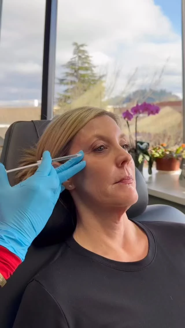 Part 2 of Toxin Tuesday! 💉 Hillary is injecting 105 units of Dysport to treat Stacy’s forehead, crow’s feet, 11’s, and bunny lines. Each area is carefully mapped to ensure smooth, balanced, and natural-looking results.🫶🏼

Call us at (541)683-3238 to book your appointment or go online using the link in our bio / store.jewellaestheticmedspa.com! 💖 

“A Reputation Built on Results” 🩷💚
