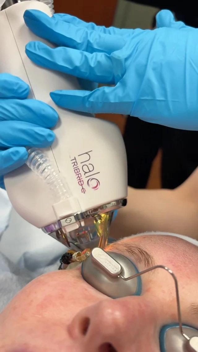 Get Your Skin Holiday-Ready! Now is the perfect time to refresh your skin before the holiday season! Enjoy 20% OFF laser, light, and facial packages, plus 20% OFF select skin-tightening treatments and exclusive packages created just for you! 💗

Don’t wait! Start your skin prep now for your holiday glow!✨ Call our office at 541-683-3238 or head online using the link in our bio / store.jewellaestheticmedspa.com to snag our biggest sale of the year! 🍂

“A Reputation Built on Results” 🩷💚
#medspaeugene #laser #sciton #sale #jewellaestheticmedspa