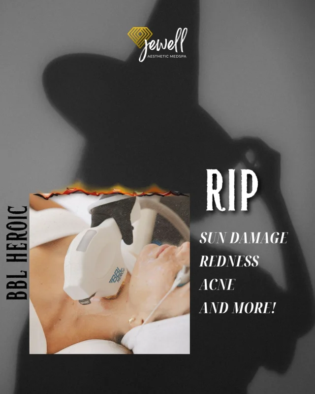 RIP SUN DAMAGE, REDNESS & ACNE!💀 BBL HEROic does more than you think! From sun damage and redness to acne and uneven skin tone! 🎃
Take advantage of 20% OFF a package of 3, or pair BBL with another laser to tackle multiple skin concerns and customize your results! 🖤

Call our office at 541-683-3238 or head online using the link in our bio / store.jewellaestheticmedspa.com to snag our biggest sale of the year! 🍂

“A Reputation Built on Results” 🩷💚
#resultsmatter #tribrid #halo #halotribrid #jewellaestheticmedspaeugeneoregon #eugene #eugeneoregon #medspaeugeneoregon #medspa #skincare #halo #bblforeveryoung #bbl #sofwave #skintightening #skinfirming #obagiskincare #skinmedica #Moxi #skintexture #skinmedica #obagi #skincare #JAMS #laserhairremoval